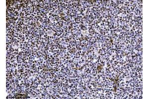 IHC analysis of NDFIP2 using anti-NDFIP2 antibody (ABIN7600173).