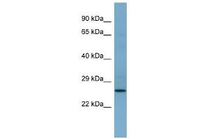 APIP antibody used at 1 ug/ml to detect target protein.