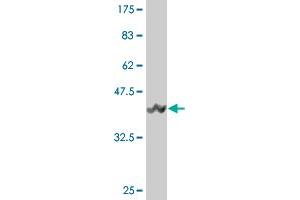 Western Blot detection against Immunogen (42. (UBE2B antibody  (AA 1-152))