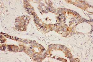 Immunohistochemistry (IHC) image for anti-Heat Shock Protein 90kDa alpha (Cytosolic), Class A Member 1 (HSP90AA1) (AA 2-365) antibody (ABIN3043847)