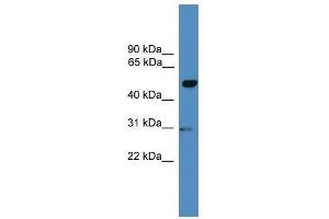 GAL3ST3 antibody used at 0. (GAL3ST3 antibody  (Middle Region))
