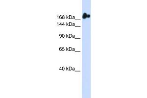WB Suggested Anti-NUP98 Antibody Titration:  0. (NUP98 antibody  (N-Term))
