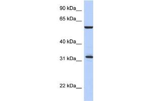 WB Suggested Anti-CDC34 Antibody Titration:  0. (CDC34 antibody  (Middle Region))