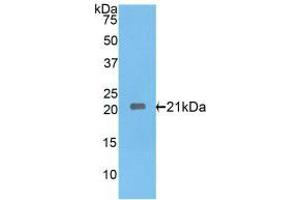 Western blot analysis of recombinant Rat IL17RE.