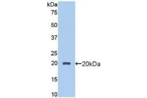 Detection of Recombinant PROCR, Human using Polyclonal Antibody to Endothelial protein C receptor (EPCR) (PROCR antibody  (AA 63-205))