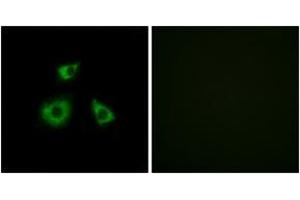 Immunofluorescence analysis of HuvEc cells, using MRPL52 Antibody. (MRPL52 antibody  (AA 71-120))