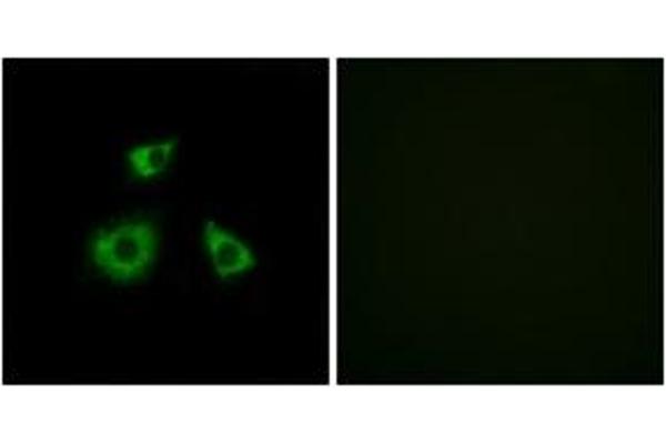MRPL52 antibody  (AA 71-120)