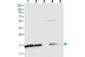 Western blot analysis of Lane 1: RT-4, Lane 2: U-251 MG, Lane 3: Human Plasma, Lane 4: Liver, Lane 5: Tonsil with NDUFAF3 polyclonal antibody . (NDUFAF3 antibody)