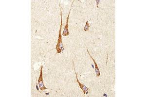 Immunohistochemical analysis of paraffin-embedded H. (PDIA6 antibody  (AA 144-172))