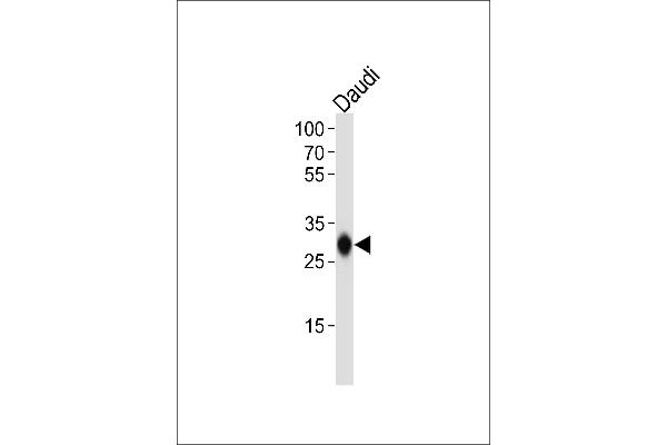 HLA-DQB1 antibody  (N-Term)