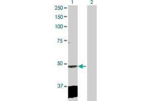 Western Blot analysis of CLP1 expression in transfected 293T cell line by CLP1 MaxPab polyclonal antibody. (CLP1 antibody  (AA 1-425))