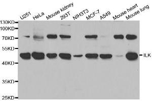 Western blot analysis of extracts of various cell lines, using ILK antibody. (ILK antibody  (AA 1-260))