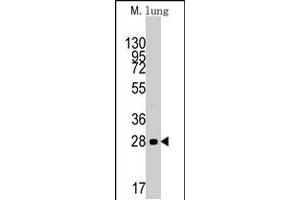 Western blot analysis of CCND1 polyclonal antibody  in mouse lung tissue lysates (35 ug/lane). (Cyclin D1 antibody  (AA 147-175))