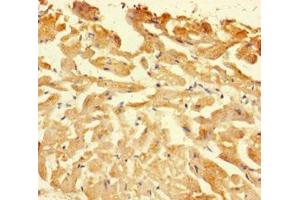 Immunohistochemistry of paraffin-embedded human heart tissue using ABIN7146926 at dilution of 1:100 (Caspase 1 antibody  (AA 120-269))