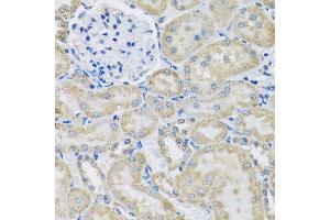 Immunohistochemistry of paraffin-embedded rat kidney using DCP2 antibody at dilution of 1:100 (x40 lens). (DCP2 antibody)