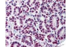 Immunohistochemistry (IHC) image for anti-Signal Transducer and Activator of Transcription 5A (STAT5A) (pTyr694) antibody (ABIN349611)
