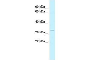 WB Suggested Anti-FOXK2 Antibody Titration: 1. (Forkhead Box K2 antibody  (C-Term))