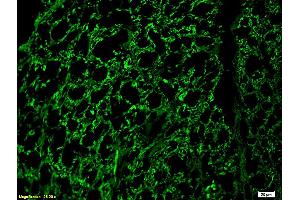 Formalin-fixed and paraffin embedded rat spinal cord labeled with Rabbit Anti-NF-H/Neurofilament H/Neurofilament 200 Polyclonal Antibody (ABIN672156), Unconjugated 1:200 followed by conjugation to the secondary antibody and DAB staining. (NEFH antibody  (AA 1-100))