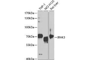 Western blot analysis of extracts of various cell lines, using IR antibody (ABIN6130501, ABIN6142519, ABIN6142521 and ABIN6221129) at 1:1000 dilution.