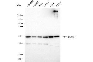 Western blotting analysis using DDOST antibody (ABIN7798383). (DDOST antibody)
