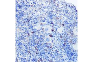 Immunohistochemistry of paraffin-embedded mouse spleen using TLR9 Rabbit pAb (ABIN7270849) at dilution of 1:100 (40x lens). (TLR9 antibody  (AA 350-450))