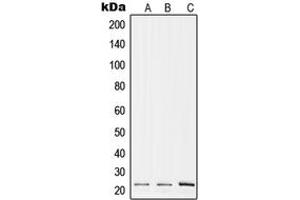 Western blot analysis of RPL17 expression in A375 (A), Raw264. (RPL17 antibody  (Center))