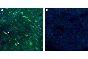 Free-floating frozen brain sections from a paraformaldehyde-perfused rat were incubated with Anti-GPR88 Antibody (ABIN7884999, 1:300), followed by goat anti-rabbit secondary antibody conjugated to Alexa Fluor® 488 (green).