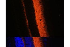 Immunofluorescence analysis of Mouse eye using SYT1 Polyclonal Antibody at dilution of 1:100 (40x lens). (SYT1 antibody)