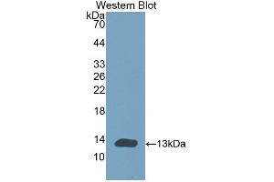 Detection of Recombinant CHRNa1, Human using Polyclonal Antibody to Cholinergic Receptor, Nicotinic, Alpha 1 (CHRNa1) (CHRNA1 antibody  (AA 21-255))