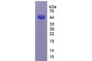 SDS-PAGE analysis of Human Carbonic Anhydrase IX Protein. (CA9 Protein)