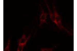 ABIN6274320 staining HepG2 by IF/ICC. (LTB antibody  (C-Term))