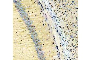 IHC analysis of NFIA using anti-NFIA antibody (ABIN4886680). (NFIA antibody  (Middle Region))