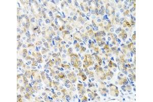 Immunohistochemistry of paraffin-embedded Mouse stomach using RAD51C Polyclonal Antibody at dilution of 1:100 (40x lens). (RAD51C antibody)