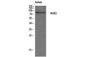 Western Blotting (WB) image for anti-NADPH Oxidase 5 (NOX5) (C-Term) antibody (ABIN3185943) (NOX5 antibody  (C-Term))