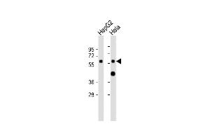 All lanes : Anti-CYP7A1 Antibody (N-term) at 1:2000 dilution Lane 1: HepG2 whole cell lysates Lane 2: Hela whole cell lysates Lysates/proteins at 20 μg per lane. (CYP7A1 antibody  (N-Term))