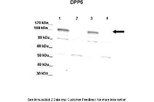 Lanes:   Lane 1: 20ug mouse WT brain extract  Lnae 2: DPP6 -/- mouse brain extract  Lane 3: 20ug mouse WT brain extract  4: DPP6 -/- mouse brain extract  Primary Antibody Dilution:   1:1000  Secondary Antibody:   Donkey anti-rabbit-HRP  Secondary Antibody Dilution:   1:10,000  Gene Name:   DPP6 a  Submitted by:   Jeanne M. (DPP6 antibody  (Middle Region))