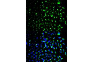 Immunofluorescence analysis of U2OS cell using HK1 antibody. (Hexokinase 1 antibody)