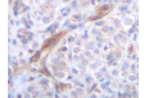 Immunohistochemistry (IHC) image for anti-Tumor Necrosis Factor (Ligand) Superfamily, Member 10 (TNFSF10) antibody (ABIN2479502) (TRAIL antibody)