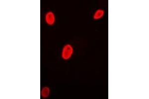 Immunofluorescent analysis of Brn-5 staining in MCF7 cells. (POU6F1 antibody)