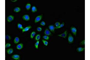 Immunofluorescent analysis of A549 cells using ABIN7157142 at dilution of 1:100 and Alexa Fluor 488-congugated AffiniPure Goat Anti-Rabbit IgG(H+L) (IZUMO1 antibody  (AA 22-292))