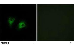 Immunofluorescence analysis of COS-7 cells, using CELSR2 polyclonal antibody . (CELSR2 antibody)