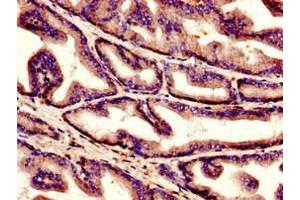 Immunohistochemistry of paraffin-embedded human prostate tissue using ABIN7148337 at dilution of 1:100 (C1QC antibody  (AA 27-157))