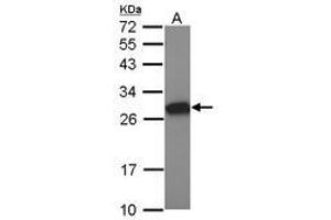 Image no. 1 for anti-Metallothionein-Like 5, Testis-Specific (Tesmin) (MTL5) (AA 1-311) antibody (ABIN1499585) (MTL5 antibody  (AA 1-311))