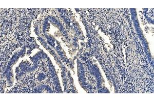 IHC analysis of HYI using anti-HYI antibody (ABIN7601796). (HYI antibody  (AA 46-277))