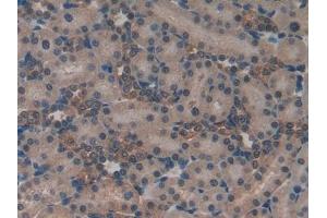 Detection of ND5 in Rat Kidney Tissue using Polyclonal Antibody to NADH Dehydrogenase 5 (ND5) (MT-ND5 antibody  (AA 425-562))