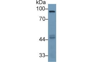Detection of MMP9 in Human HepG2 cell lysate using Monoclonal Antibody to Matrix Metalloproteinase 9 (MMP9) (MMP 9 antibody  (AA 226-391))