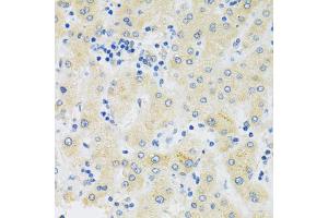 Immunohistochemistry of paraffin-embedded human liver using SLC39A7 antibody (ABIN5971725) at dilution of 1/100 (40x lens). (SLC39A7 antibody)