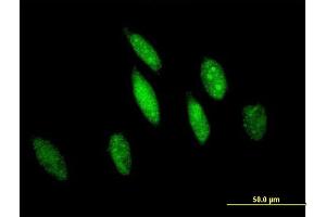 Immunofluorescence of purified MaxPab antibody to GSTO1 on HeLa cell. (GSTO1 antibody  (AA 1-241))