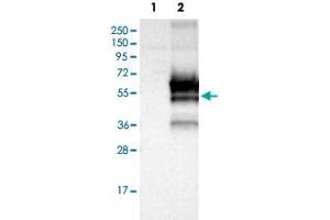 Western blot analysis of Lane 1: Negative control (vector only transfected HEK293T lysate); Lane 2: Over-expression lysate (Co-expressed with a C-terminal myc-DDK tag (~3. (FRMD8 antibody)