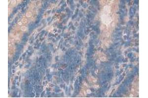 IHC-P analysis of Rat Intestine Tissue, with DAB staining. (Growth Hormone Receptor antibody  (AA 353-588))